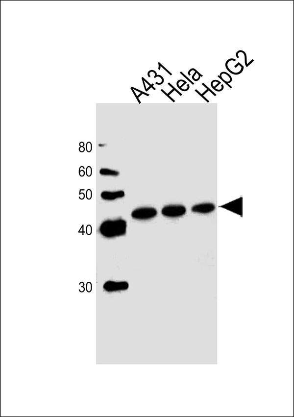 WB - CSNK2A1 Antibody (Center) AW5043-U100